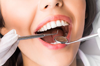 Periodontal Surgery in Marshall IL